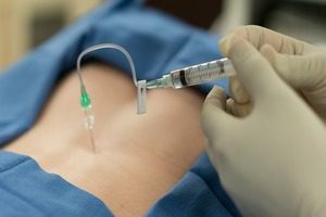 Fundamentos de Anestesia Regional