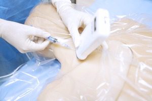 Interactivo de instalación de catéter venoso central bajo ecografía