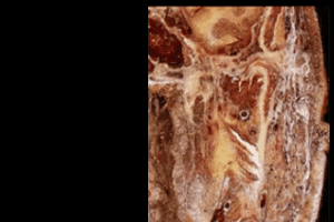 Diplomado en Anatomía de cabeza y cuello