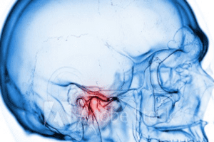 articulación temporomandibular