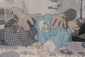 Diplomado en Kinesiología respiratoria pediátrica